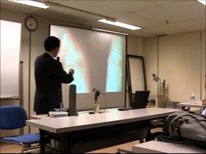 引起急性腎損傷的感染