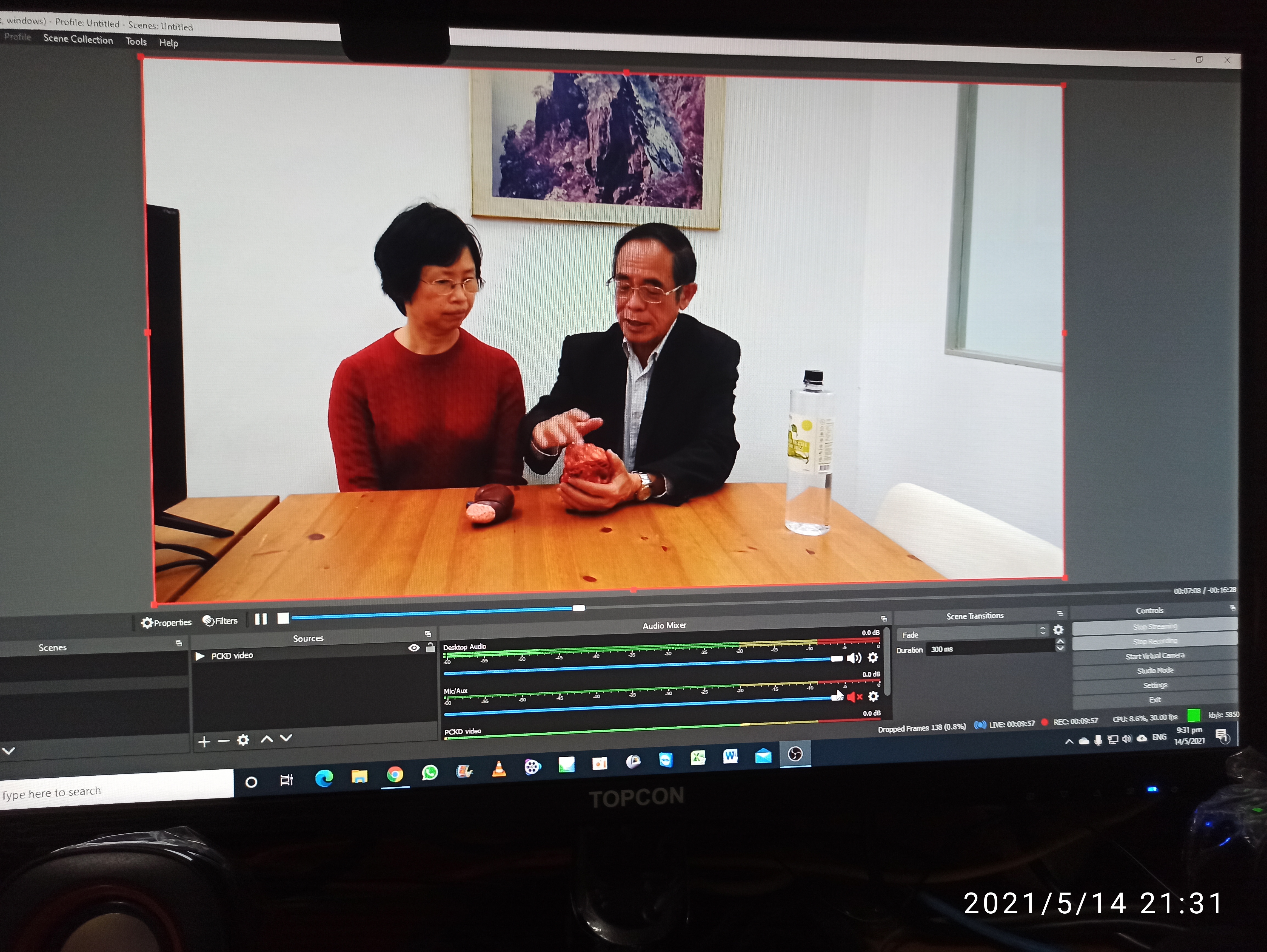 先天性多囊腎病的基本知識